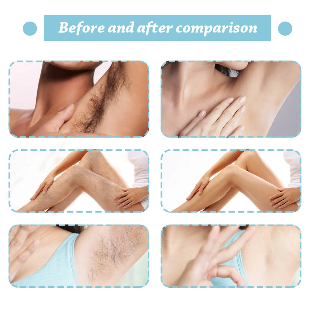Permanent Hair Removal Spray Hair Growth Inhibitor Natural Painless Depilatory Cream Body Armpit Private Parts Hair Remover 20ml