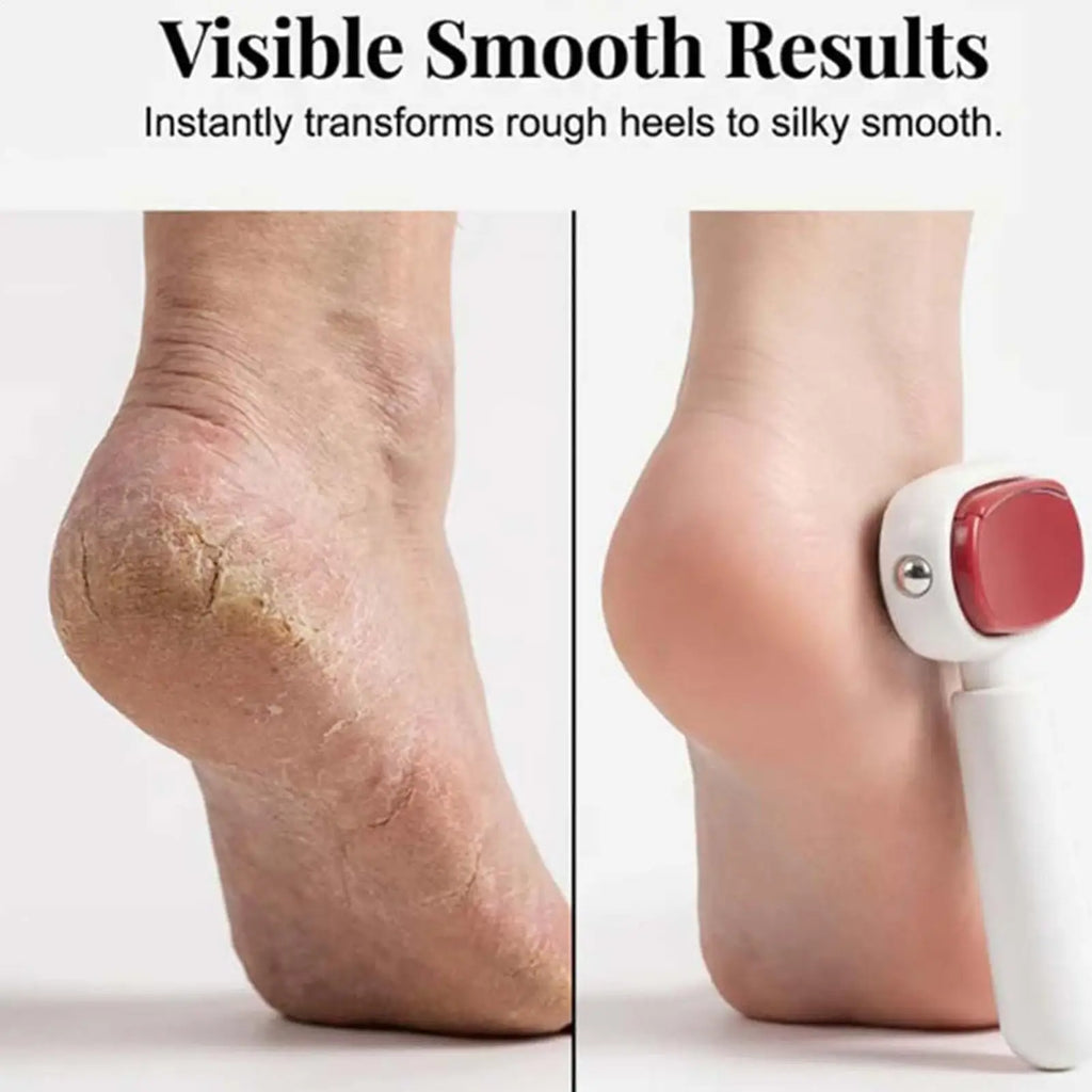 Double Side Foot Rasp Hard Dead Skin File Calluses Remover Foot Care Pedicure Grinding Tools Stainless Steel Beauty Tools